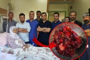 Kalbinden 400 gram t&uuml;m&ouml;r &ccedil;ıkarıldı!