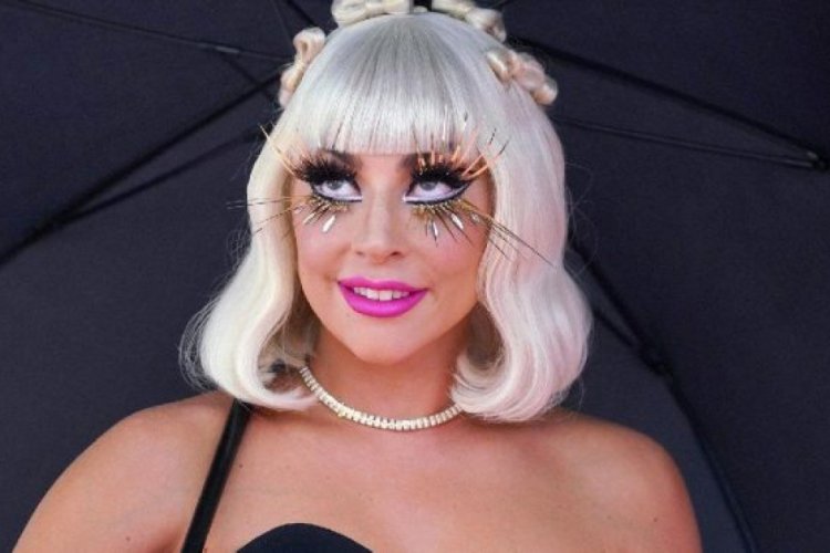 Sahneden d&uuml;şen Lady Gaga'dan r&ouml;ntgenli "iyiyim" mesajı