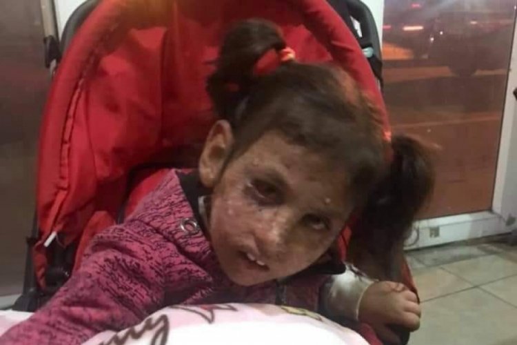 Kanser hastası kız i&ccedil;in 3 saate 25 bin TL toplandı