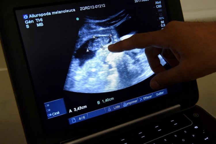 Portekiz'de y&uuml;z&uuml; olmayan bebek d&uuml;nyaya geldi