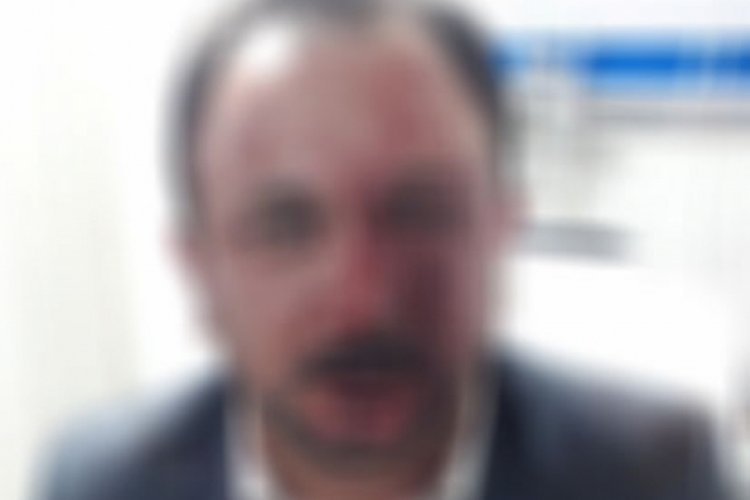 Bursa'da saldırıya uğrayan sendika başkanı hakkında şoke eden iddia!