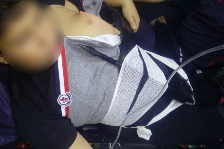 &Uuml;zerinden atlamak istediği demir korkuluklar, 10 yaşındaki &ccedil;ocuğun v&uuml;cuduna saplandı