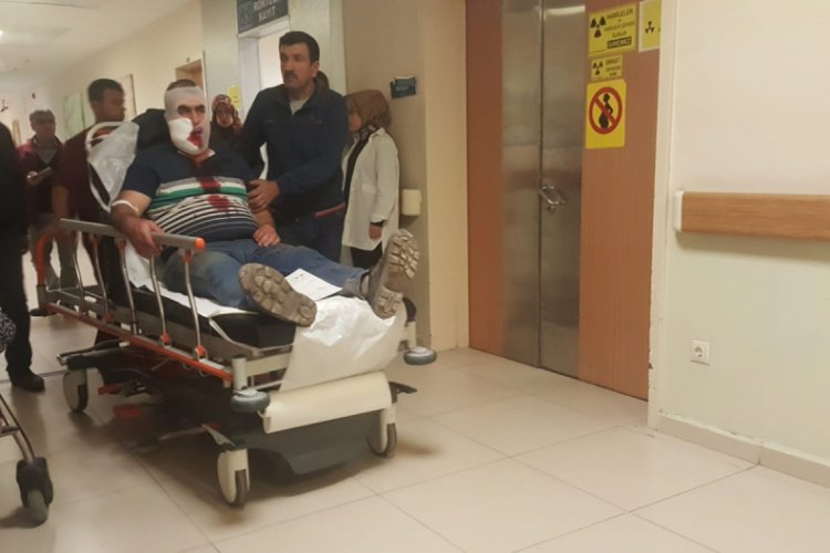 Bursa'da kopan vincin demiri suratına &ccedil;arptı