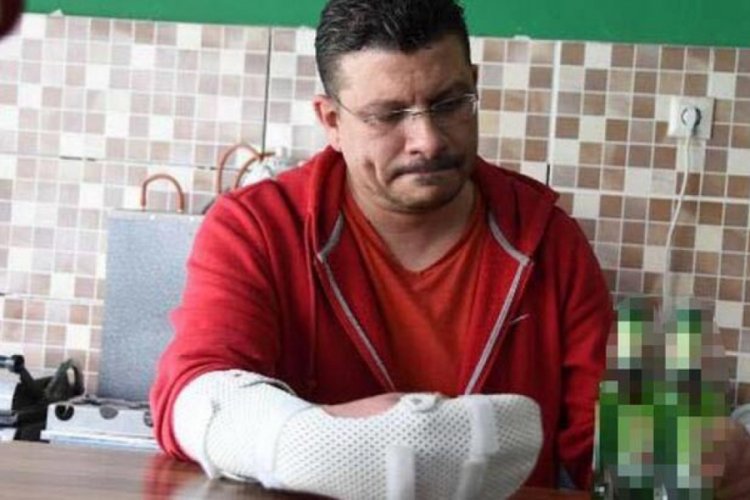 Soda şişeleri elinde patladı!