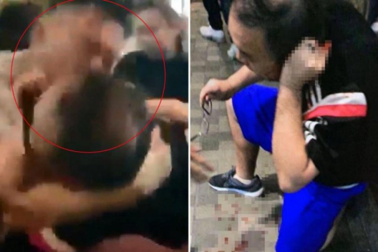 Meclis üyesinin kulağını ısırarak kopardı ile ilgili görsel sonucu
