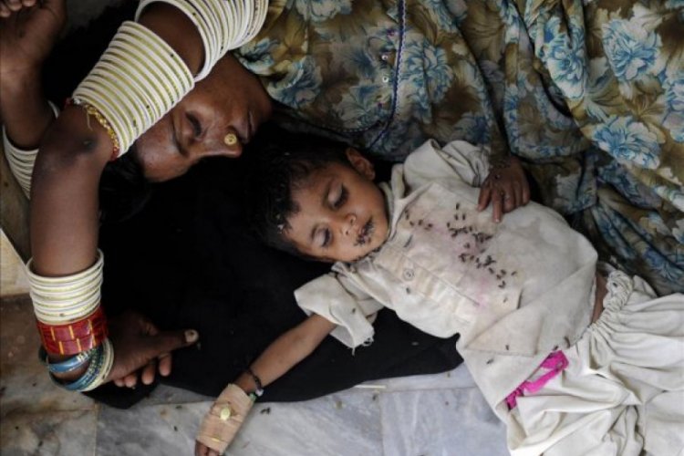 Pakistan'da tek kentte 703 &ccedil;ocuk a&ccedil;lıktan &ouml;ld&uuml;