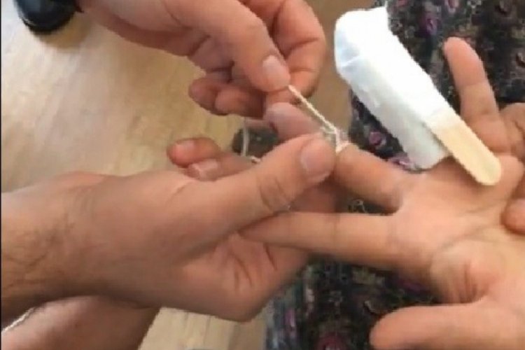 Parmağına sıkışan y&uuml;z&uuml;ğ&uuml; itfaiye eri saniyeler i&ccedil;inde &ccedil;ıkardı
