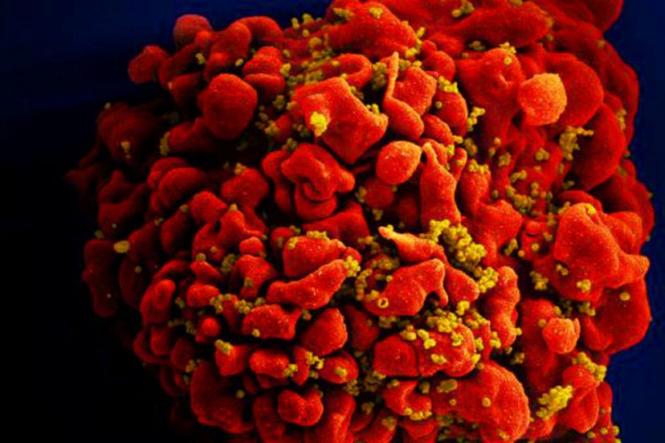 Bilim insanları yeni bir HIV türü keşfetti