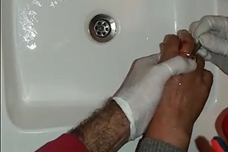 Parmağında sıkışan y&uuml;z&uuml;ğ&uuml; itfaiye &ccedil;ıkardı
