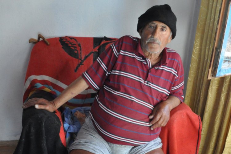 Fil hastalığı bacaklarını yok ediyor