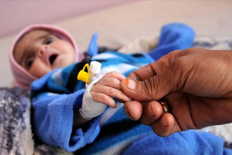 UNICEF: Yemen'de 12 milyon &ccedil;ocuk acil yardıma muhta&ccedil;