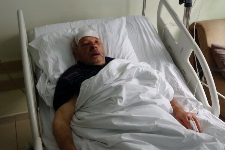 Kamyonet kapağının &ccedil;arpmasıyla yaralandı, en &ccedil;ok dişlerinin kırılmasına &uuml;z&uuml;ld&uuml;