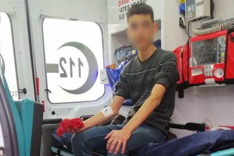 T&uuml;fek geri tepince y&uuml;z&uuml;nden yaralandı