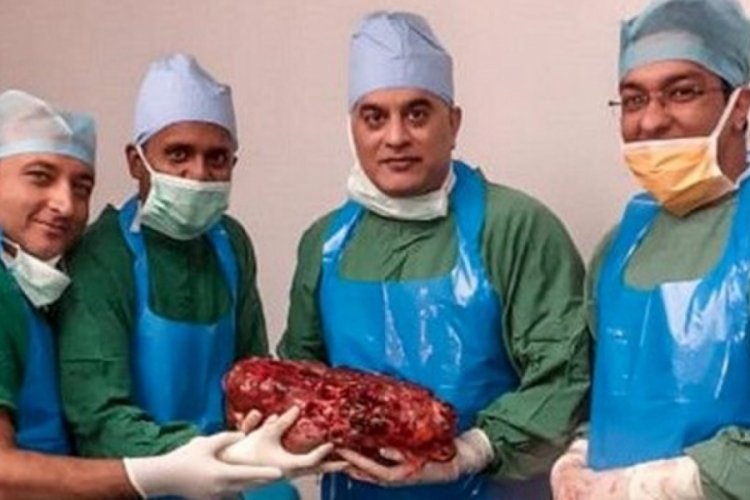 Hindistan'da hastanın 7,4 kilogramlık b&ouml;breği alındı