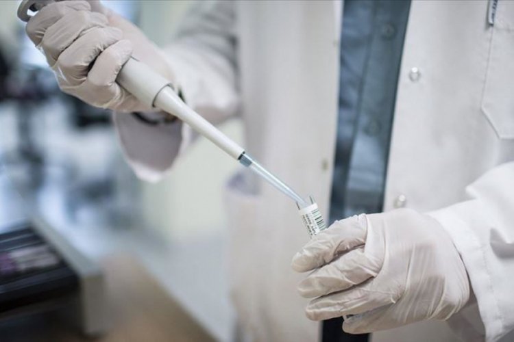 'T&uuml;rkiye'de her yıl ortalama 3-4 bin kişiye AIDS tanısı konuyor'