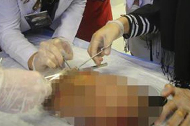 Ger&ccedil;ek ortaya &ccedil;ıkınca kapatıldı! Binlerce kadavra...