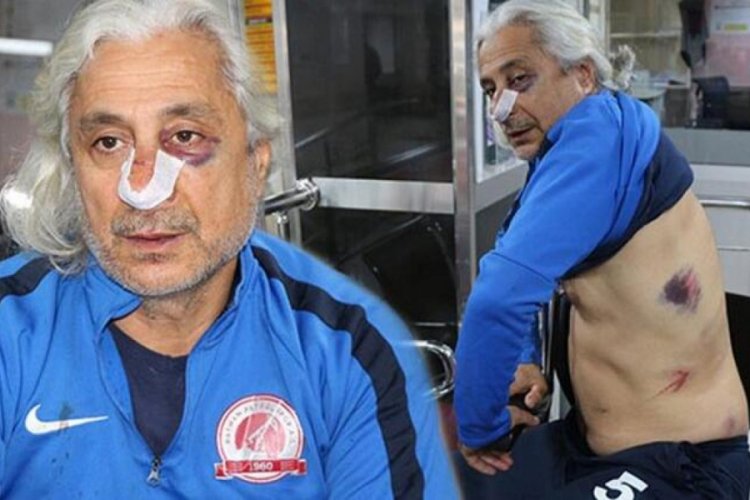 Teknik direkt&ouml;r ve futbolcularını demir sopalarla d&ouml;vd&uuml;ler