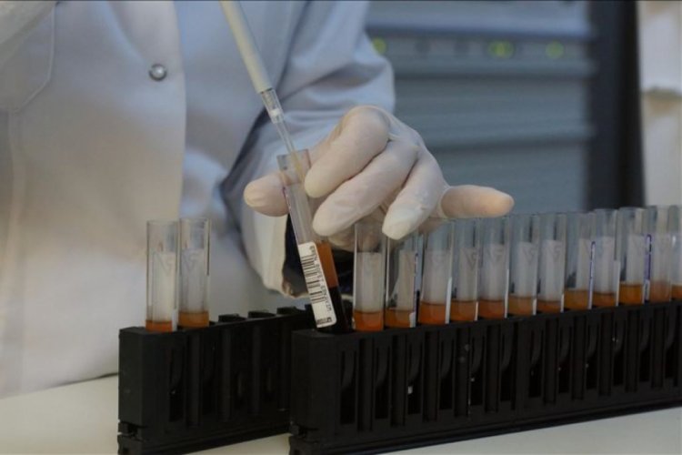 HIV'de 'dışlanma' teşhis ve tedaviyi engelliyor