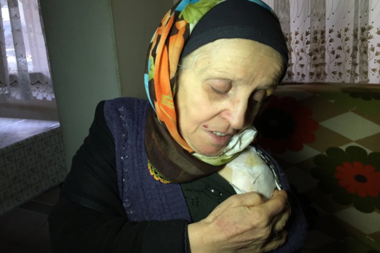 Eşinin kaynar su d&ouml;kerek yaktığı kadın: Yapma diye yalvardım