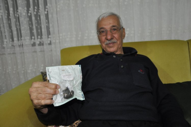 Kaya par&ccedil;ası b&uuml;y&uuml;kl&uuml;ğ&uuml;nde b&ouml;brek taşı &ccedil;ıkarıldı