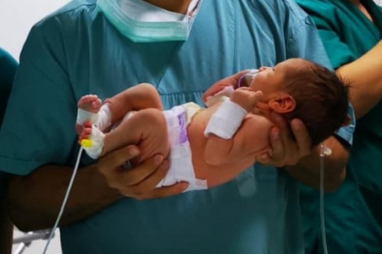 10 binde bir g&ouml;r&uuml;len doğum vakası Trabzon'da yaşandı