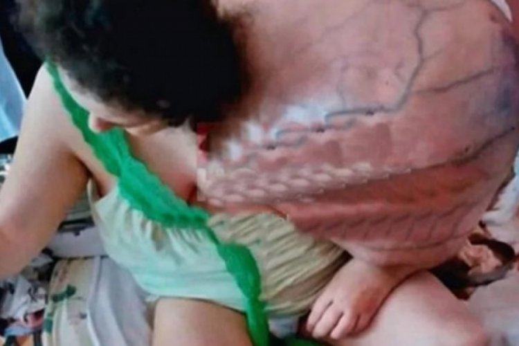 Omzundaki t&uuml;m&ouml;r kendi ağırlığını ge&ccedil;ti!
