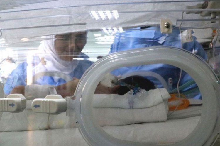 Mide ve bağırsakları dışarıda doğan bebek sağlığına kavuşturuldu