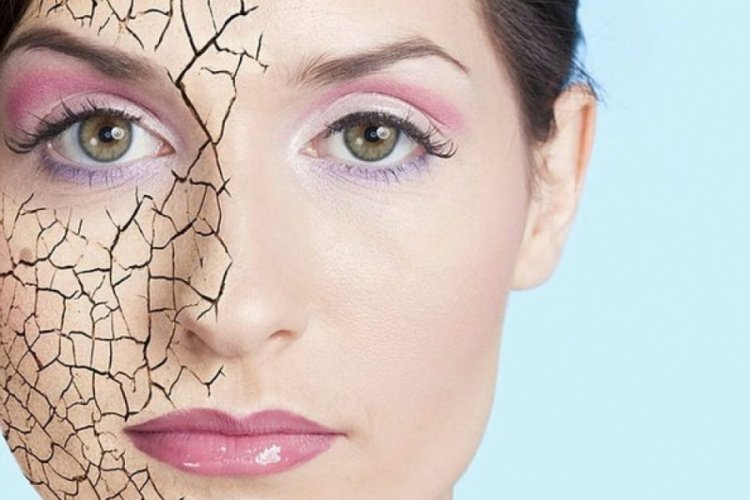 Cilt kuruluğuna karşı alınması gereken &ouml;nlemler