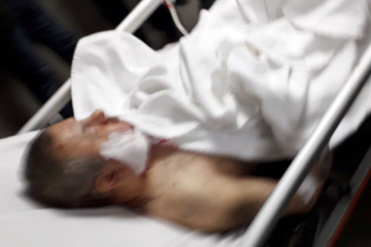 Bursa'da g&ouml;rme engelli komşusunu kafasından bı&ccedil;aklayan sanığın, akıl sağlığı araştırılacak