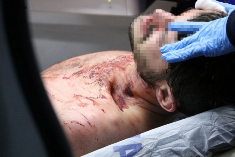 Evden kovulunca kapıyı kilitleyip kendine zarar verdi