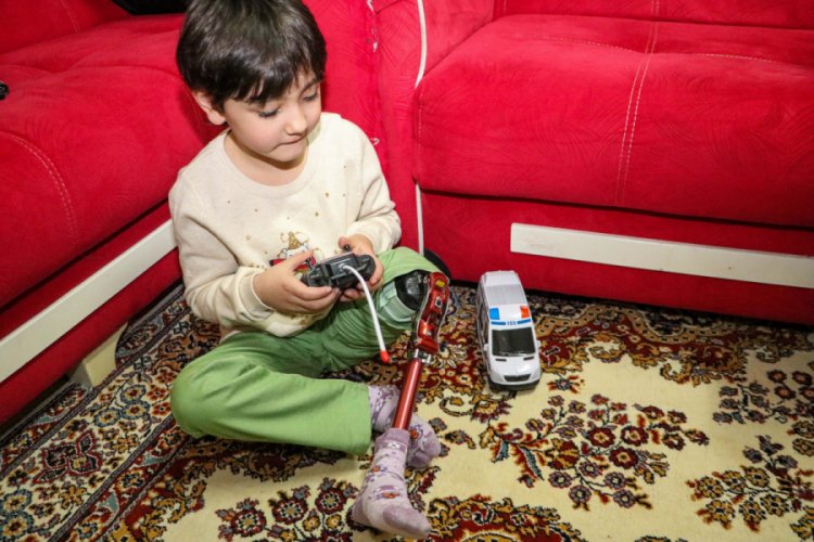 &Ouml;zge'nin yaşı b&uuml;y&uuml;d&uuml;k&ccedil;e yeni protez gerekiyor