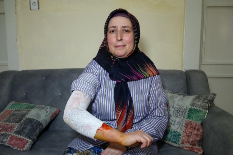 'Misafiri yalnız bıraktın' deyip, 17 yıllık eşini sıcak suyla haşladı