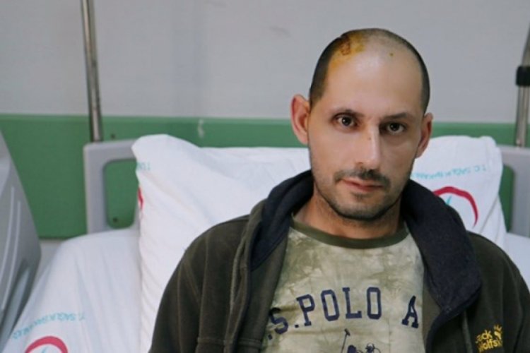 3 boyutlu yazıcıda yapılan titanyum kafatası par&ccedil;ası hastaya uygulandı