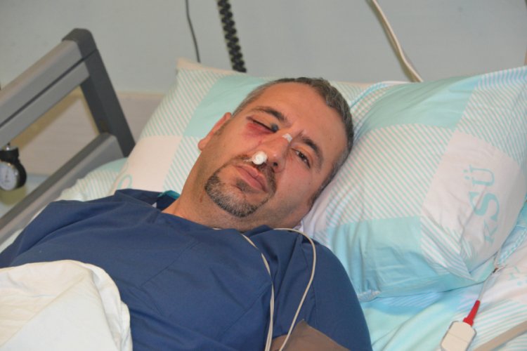 Saldırıya uğrayan sağlık teknikerinin elmacık kemiği kırıldı