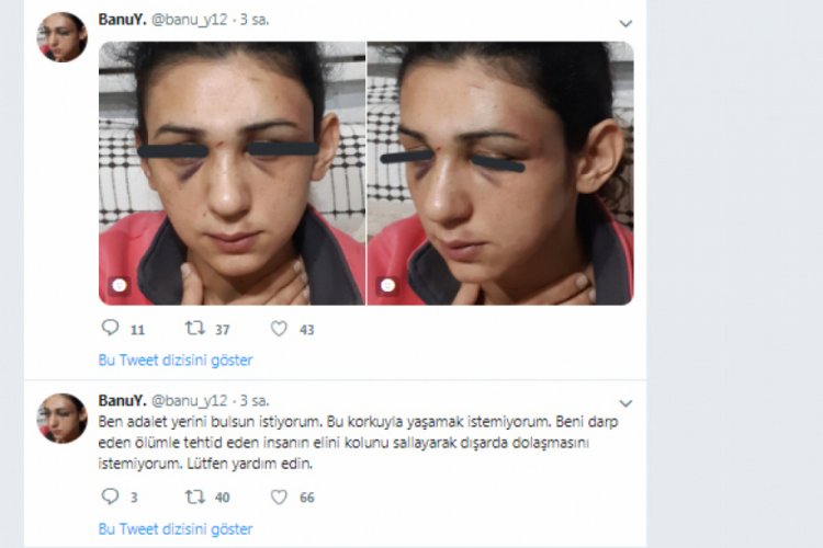 Şiddet g&ouml;ren kadın, sosyal medyadan yardım istedi