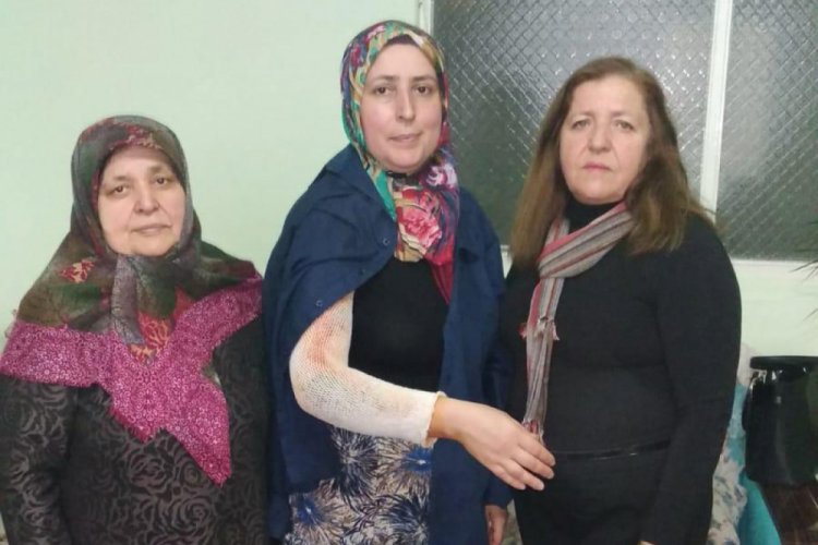 Eşi tarafından kolu yakılan kadına destek