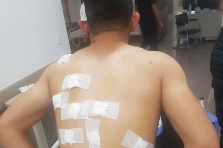 Kaybolan koyununu ararken avcıların hedefi oldu