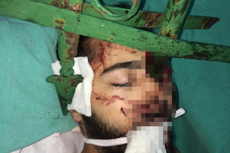 Y&uuml;z&uuml;ne demir saplanan Emre, yoğun bakımdan &ccedil;ıktı