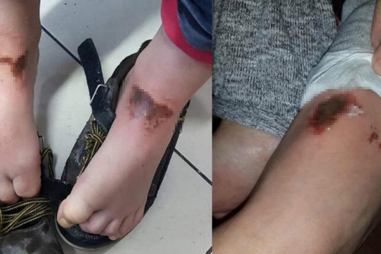 Karla oynarken bu hale gelmişlerdi! Yeni gelişme...