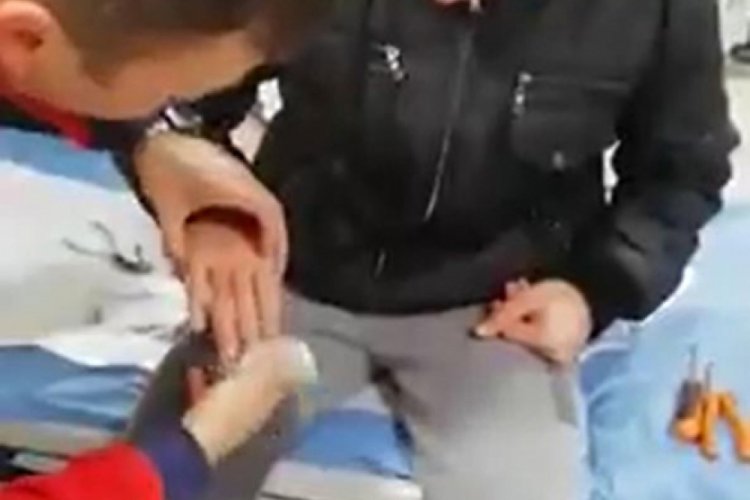 Parmağına sıkışan y&uuml;z&uuml;ğ&uuml; itfaiye &ccedil;ıkardı