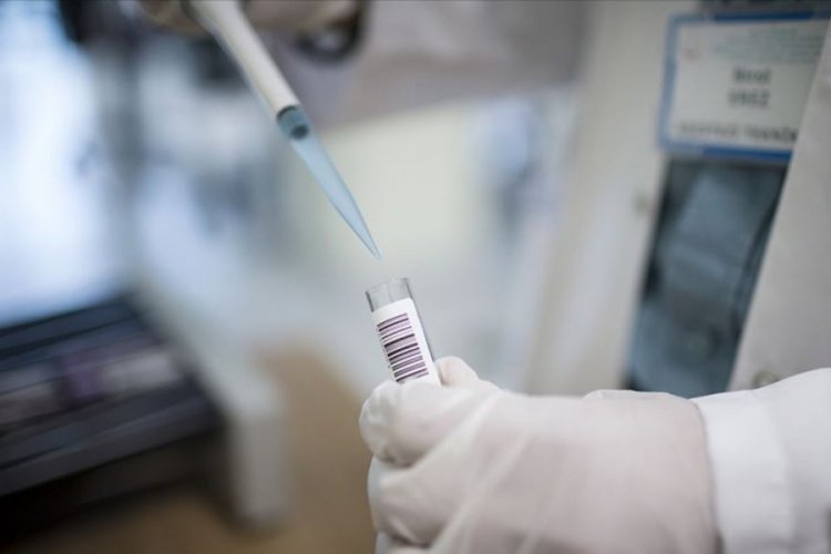 T&uuml;rkiye'de 2019'da 2 yeni c&uuml;zzam vakası g&ouml;r&uuml;ld&uuml;
