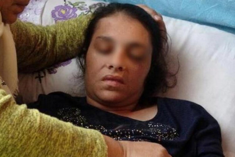 Eşi tarafından d&ouml;v&uuml;len kadın, yatağa mahkum kaldı!