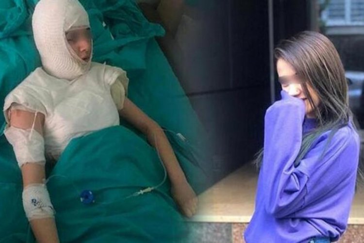 &Uuml;vey kızına kaynar su d&ouml;kt&uuml;ğ&uuml; iddia edilmişti... İfadesi ortaya &ccedil;ıktı