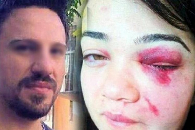 Eşine şiddet uygulayan adam elektronik kelep&ccedil;eyi kırdı