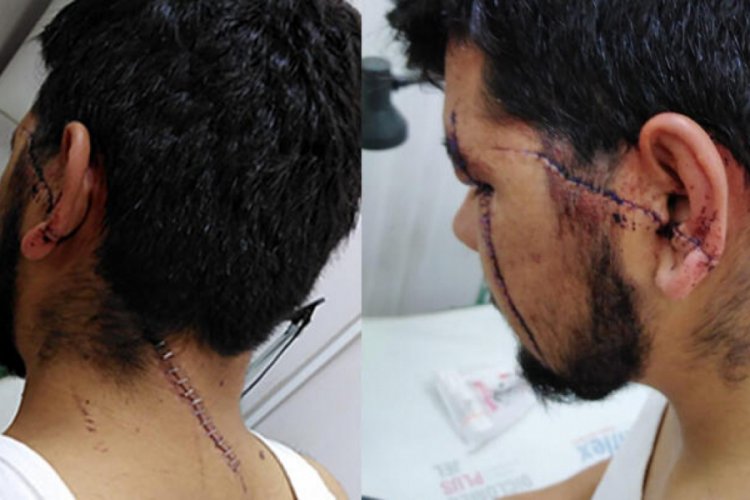 Yol verme kavgasında dehşeti yaşadılar!