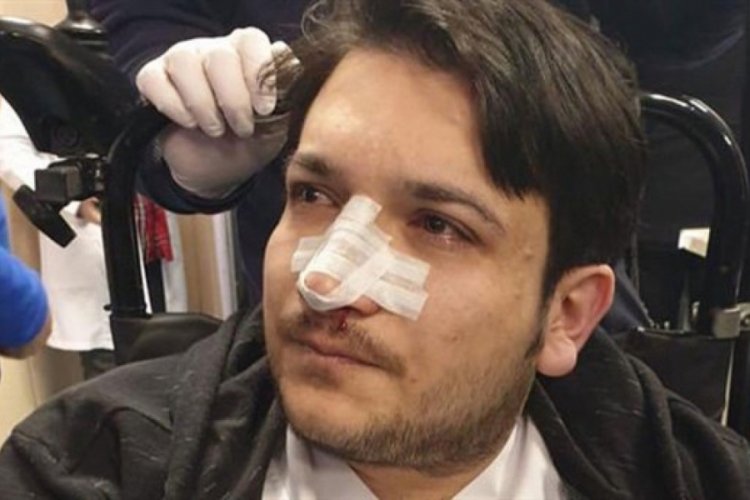 Doktorun burnunu kıran sanık ilk duruşmada tahliye oldu