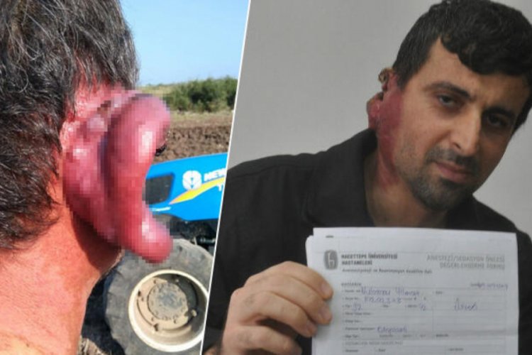 7 yıldır kulağının her tarafını sarıyor