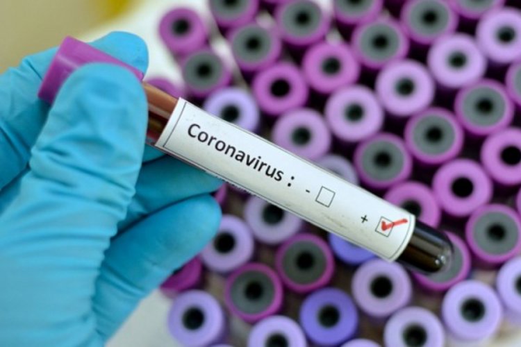 Rusya'dan Corona vir&uuml;s&uuml; aşısı a&ccedil;ıklaması