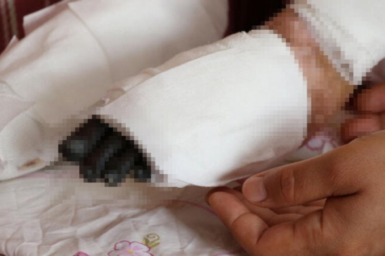 Nadir hastalık kız &ccedil;ocuğunu eve mahkum etti!