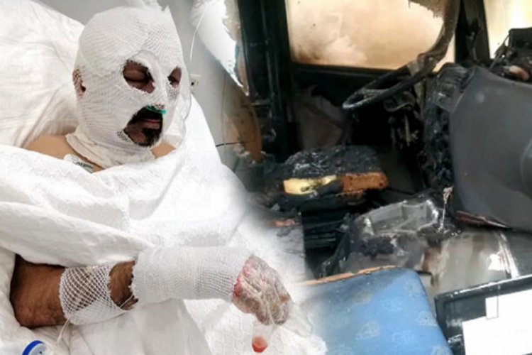 &Ouml;ğrenci servisi şof&ouml;r&uuml;n&uuml;n &uuml;zerine tiner d&ouml;k&uuml;p, yakan kadın tutuklandı